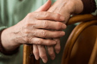 rheumatoid arthritis