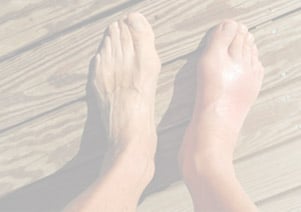 Gout Treatment in Dubai 